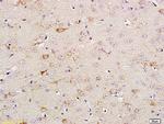 Phospho-TrkA (Tyr680, Tyr681) Antibody in Immunohistochemistry (Paraffin) (IHC (P))
