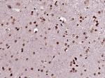 Phospho-TH (Ser31) Antibody in Immunohistochemistry (Paraffin) (IHC (P))