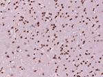 Phospho-TH (Ser31) Antibody in Immunohistochemistry (Paraffin) (IHC (P))