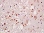 Phospho-ATG1 (Ser556) Antibody in Immunohistochemistry (Paraffin) (IHC (P))