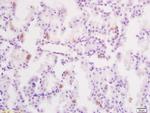 Phospho-YB1 (Ser102) Antibody in Immunohistochemistry (Paraffin) (IHC (P))