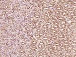 Phospho-YB1 (Ser102) Antibody in Immunohistochemistry (Paraffin) (IHC (P))
