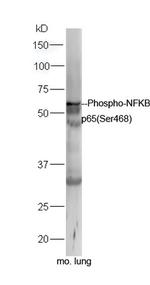Phospho-NFKB p65 (Ser468) Antibody in Western Blot (WB)