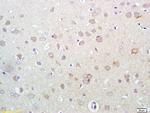 Phospho-HER3 (Tyr1289) Antibody in Immunohistochemistry (Paraffin) (IHC (P))