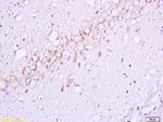 Phospho-Insulin Receptor Beta (Tyr1355) Antibody in Immunohistochemistry (Paraffin) (IHC (P))