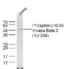 Phospho-p70 S6 Kinase Beta 2 (Tyr389) Antibody in Western Blot (WB)