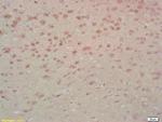 MST1 Antibody in Immunohistochemistry (Paraffin) (IHC (P))