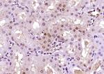 SCP3 Antibody in Immunohistochemistry (Paraffin) (IHC (P))