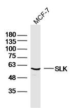 SLK Antibody in Western Blot (WB)