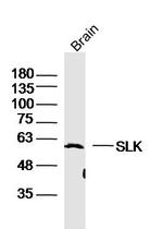 SLK Antibody in Western Blot (WB)
