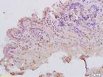 MATH1 Antibody in Immunohistochemistry (Paraffin) (IHC (P))