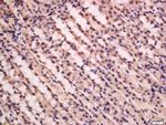 PFK2 Antibody in Immunohistochemistry (Paraffin) (IHC (P))