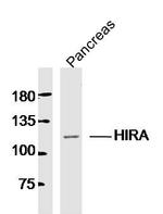 HIRA Antibody in Western Blot (WB)