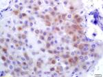PLK1 Antibody in Immunohistochemistry (Paraffin) (IHC (P))