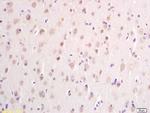 DTNB Antibody in Immunohistochemistry (Paraffin) (IHC (P))