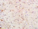 KSR1 Antibody in Immunohistochemistry (Paraffin) (IHC (P))