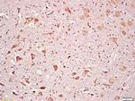 Rsk2 Antibody in Immunohistochemistry (Paraffin) (IHC (P))