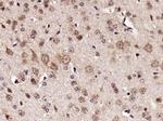 RPS6 Antibody in Immunohistochemistry (Paraffin) (IHC (P))