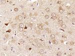 RPS6 Antibody in Immunohistochemistry (Paraffin) (IHC (P))