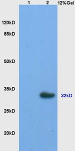 StAR Antibody in Immunohistochemistry (Paraffin) (IHC (P))