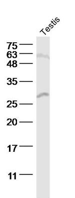StAR Antibody in Western Blot (WB)