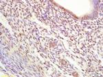KAP1 Antibody in Immunohistochemistry (Paraffin) (IHC (P))