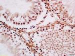 TLK1 Antibody in Immunohistochemistry (Paraffin) (IHC (P))