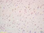 TAK1 Antibody in Immunohistochemistry (Paraffin) (IHC (P))