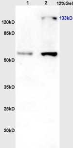 Phospho-eNOS (Thr113) Antibody in Western Blot (WB)
