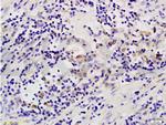 MAP3K8 Antibody in Immunohistochemistry (Paraffin) (IHC (P))