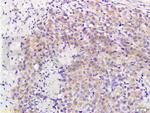 MAP3K8 Antibody in Immunohistochemistry (Paraffin) (IHC (P))