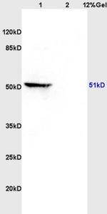 MAP3K8 Antibody in Western Blot (WB)