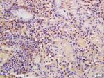 MTF-1 Antibody in Immunohistochemistry (Paraffin) (IHC (P))