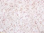 YAP1 Antibody in Immunohistochemistry (Paraffin) (IHC (P))