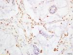 YAP1 Antibody in Immunohistochemistry (Paraffin) (IHC (P))