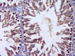 Talin1 + 2 Antibody in Immunohistochemistry (Paraffin) (IHC (P))