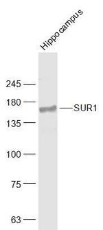 SUR1 Antibody in Western Blot (WB)