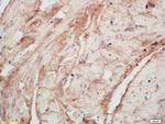 PLASTIN3/T Plastin Antibody in Immunohistochemistry (Paraffin) (IHC (P))