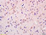 ADCY1 Antibody in Immunohistochemistry (Paraffin) (IHC (P))