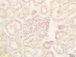 PHD2 Antibody in Immunohistochemistry (Paraffin) (IHC (P))