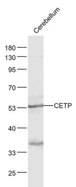 CETP Antibody in Western Blot (WB)