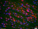 Phospho-P53 (Ser20) Antibody in Immunohistochemistry (Paraffin) (IHC (P))