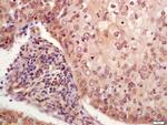 Phospho-P53 (Ser33) Antibody in Immunohistochemistry (Paraffin) (IHC (P))