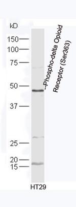 Phospho-delta Opioid Receptor (Ser363) Antibody in Western Blot (WB)