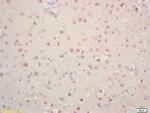Phospho-p57 Kip2 (Thr310) Antibody in Immunohistochemistry (Paraffin) (IHC (P))