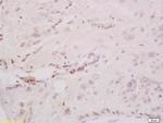 Phospho-CHK2 (Thr68) Antibody in Immunohistochemistry (Paraffin) (IHC (P))