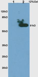 Phospho-CHK2 (Thr68) Antibody in Western Blot (WB)