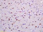 Phospho-PKC delta (Tyr313) Antibody in Immunohistochemistry (Paraffin) (IHC (P))