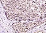 Phospho-Cyclin B1 (Ser126) Antibody in Immunohistochemistry (Paraffin) (IHC (P))