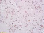 Phospho-DNA PK/PRKDC (Ser2056) Antibody in Immunohistochemistry (Paraffin) (IHC (P))